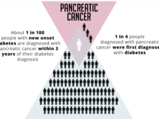 New onset diabetes is linked to pancreatic cancer; about 1 in 100 are diagnosed within 3 years, while 1 in 4 with pancreatic cancer were first diagnosed with diabetes.